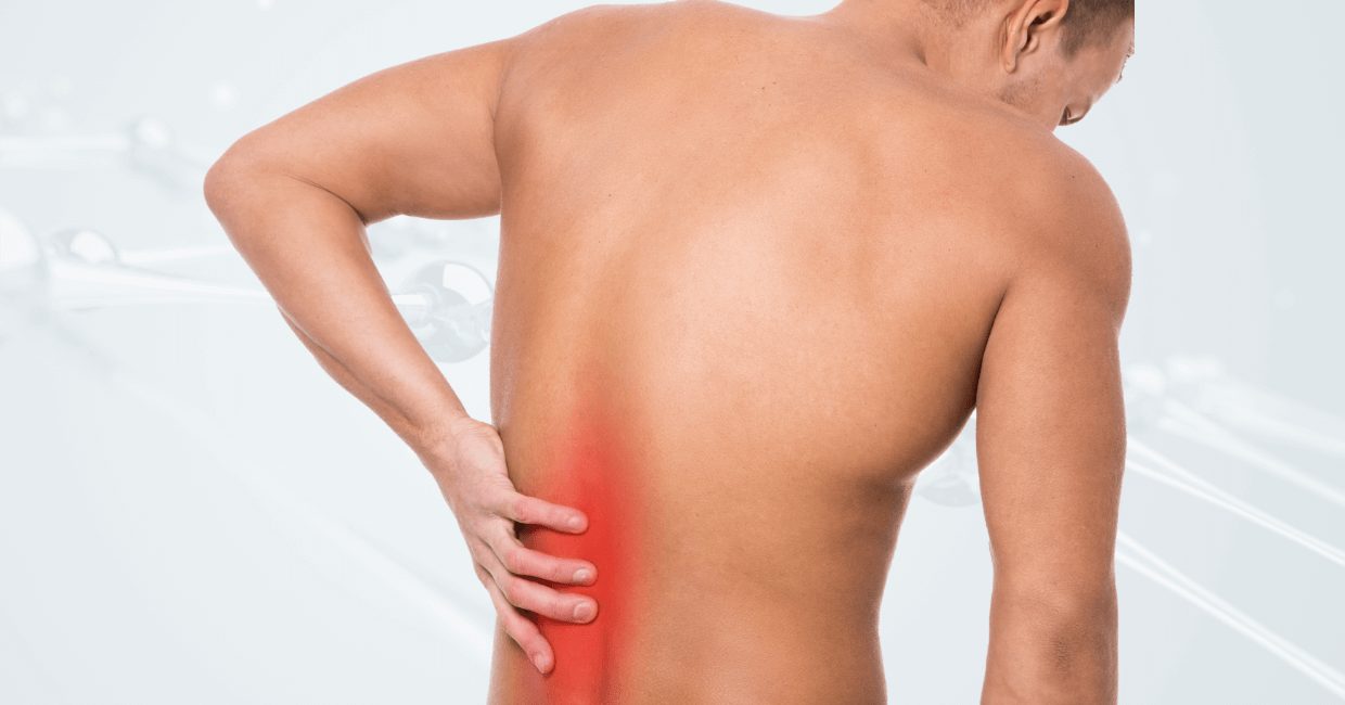 Post Laminectomy Syndrome image